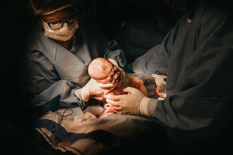 Hernia Umbilical en Bebés: Qué Es y Cuándo Se Resuelve
